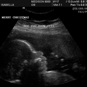 2005_Isabella_ultrasound
