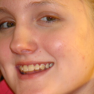2006_Isabella_at_hospital